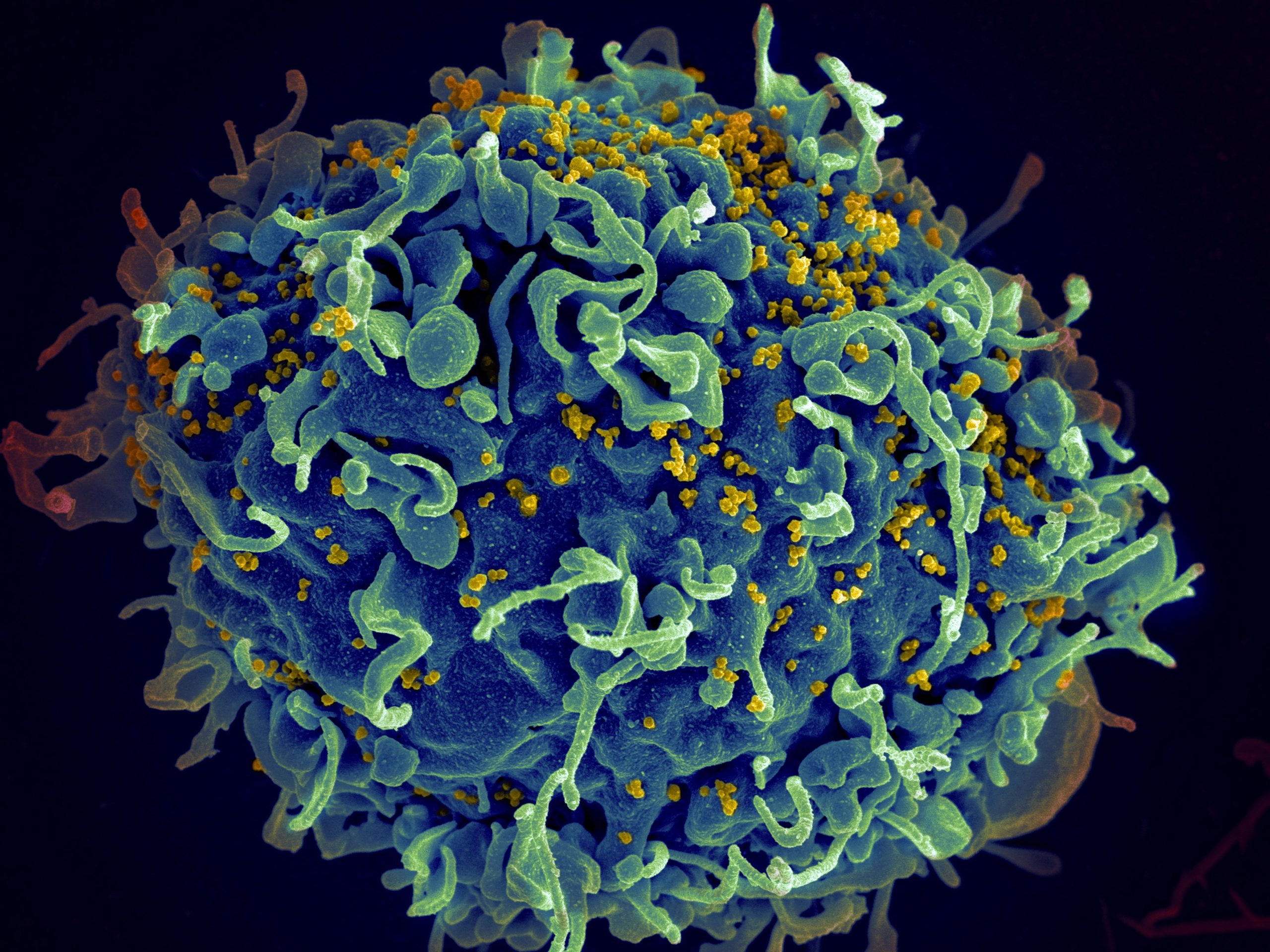 Американские учёные успешно испытали вакцину от ВИЧ  - ZDRAVBUD.NET